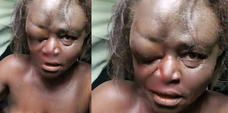 Family Of Destitute Lynched To Death In Kwara Demands Justice