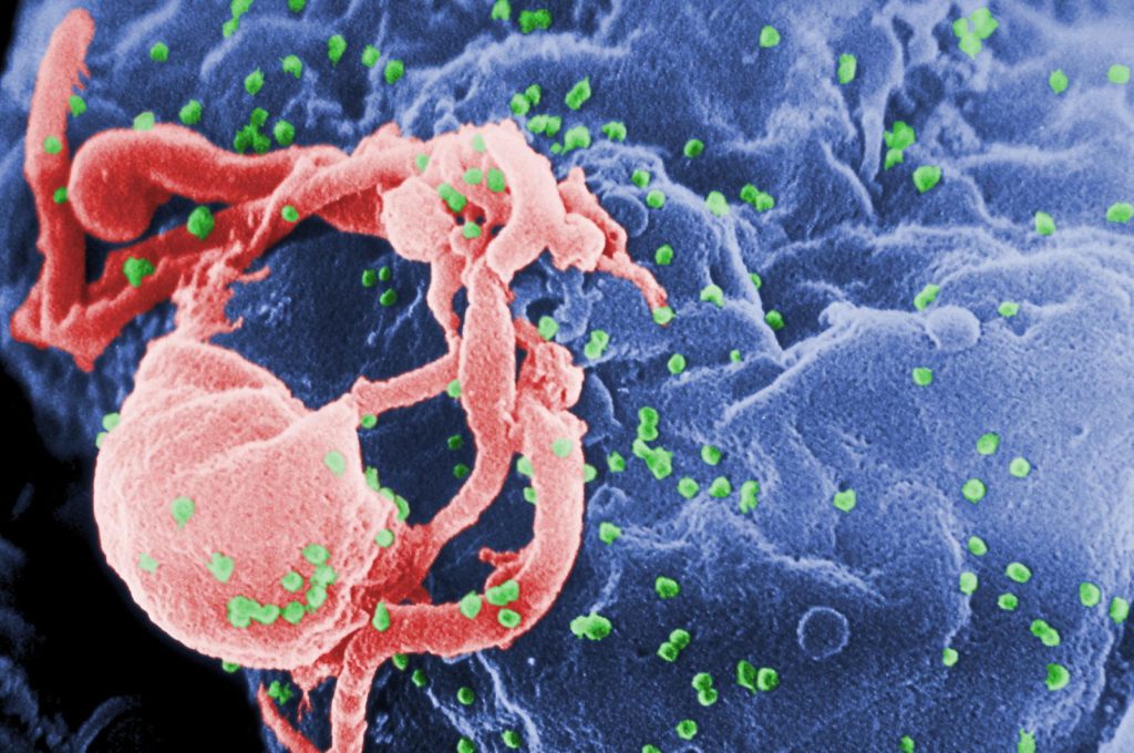 Hiv Budding Color Scaled 1