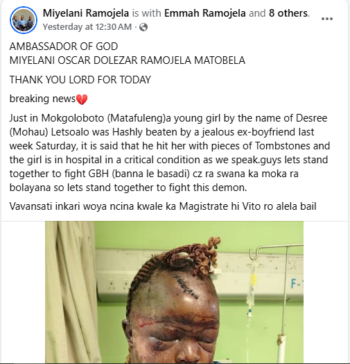 South African Woman Beaten To Pulp By Her Ex-Boyfriend