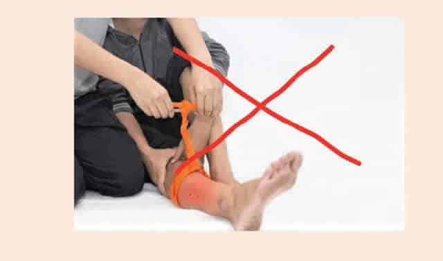 Tying legs after snakebite