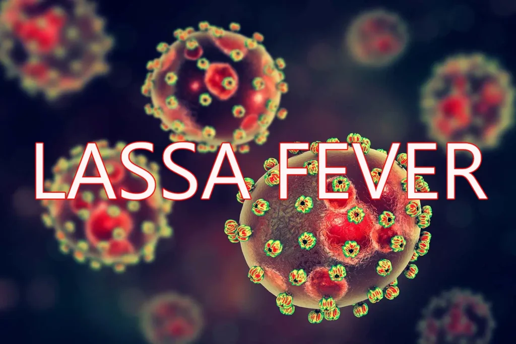 lassa fever lassa fever