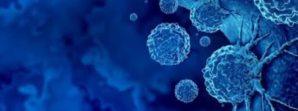 prostate cancer prostate cancer